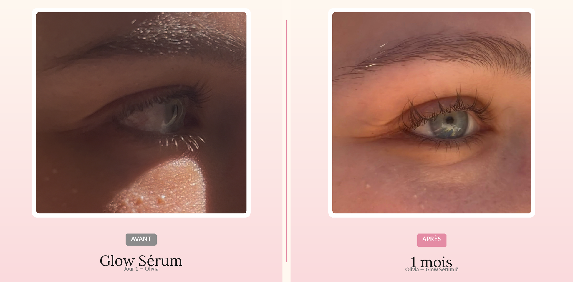 Glow Sérum — Avant / Après 1 mois d'utilisation (Olivia)